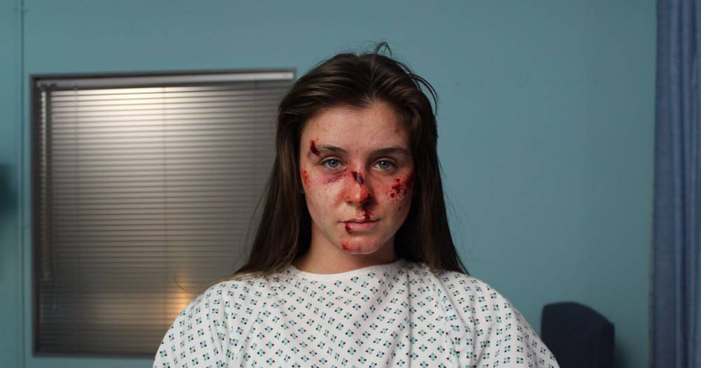 A bloody-faced Brooke Vincent as you've never seen her before in new film role - www.manchestereveningnews.co.uk - county Webster