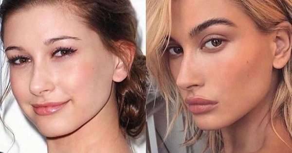 Hailey Bieber responds to plastic surgery rumor after ‘crazy’ transformation picture is posted - www.msn.com