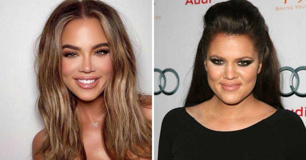 Khloe Kardashian transformation: Expert says there are ‘tell-tale signs’ of surgery as fans claim star has ‘entire new face’ - www.ok.co.uk