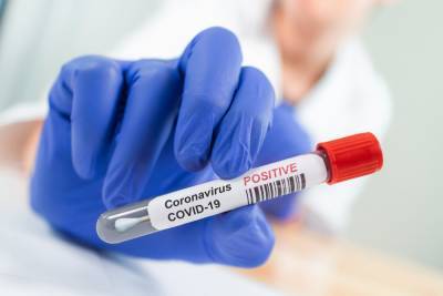 LIVE UPDATES: Newsom's coronavirus lockdown order looms this weekend for parts of California - www.foxnews.com - California