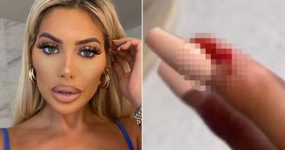 Geordie Shore's Chloe Ferry shares graphic video of bloody finger after painful injury - www.ok.co.uk