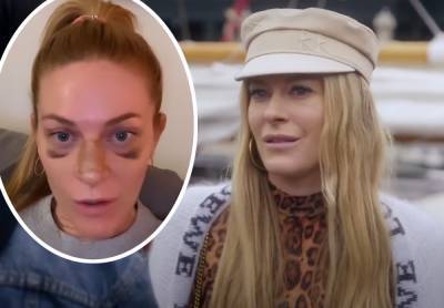 RHONY Breakout Star Leah McSweeney Gets Candid With Fans About Her Nose Job! - perezhilton.com - New York