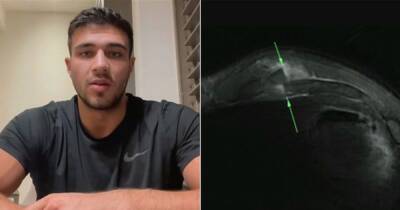Tommy Fury reveals X-ray of medical condition after pulling out of Jake Paul fight - www.manchestereveningnews.co.uk - Florida - Manchester