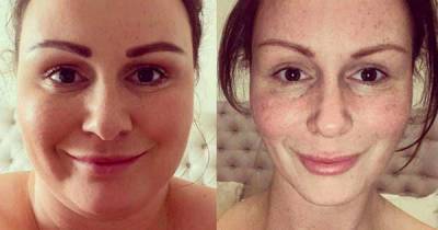 Chanelle Hayes shows off dramatic face weight loss in pictures after shedding seven stone - www.msn.com