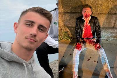Bisexual Olympic athlete Jack Woolley requires surgery after mob attack in Ireland - www.metroweekly.com - Ireland - Dublin - parish St. James