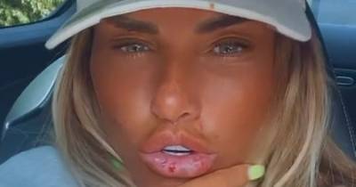 Katie Price shows off bleeding lips after 'Russian filler' treatment as she returns to UK - www.ok.co.uk - Britain - Russia - county Price