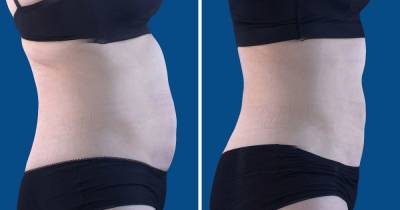 Astonishing new tummy blitz melts fat and tones abs without gym or diet - www.ok.co.uk