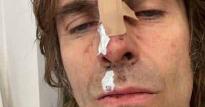 'Who said rock and roll is dead?' Liam Gallagher posts injuries on social media after 'falling out of helicopter' - www.manchestereveningnews.co.uk - county Newport - county Isle Of Wight