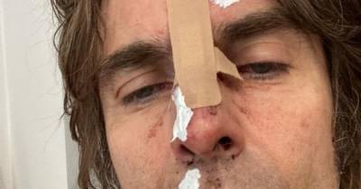 Liam Gallagher cancels gig after 'falling from helicopter' - www.manchestereveningnews.co.uk - city Belfast