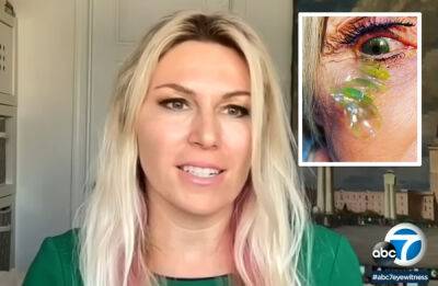 OMG?! Ophthalmologist Discovered Her Patient Had 23 Contact Lenses Lodged Underneath Her Eyelid! - perezhilton.com - California - county Newport
