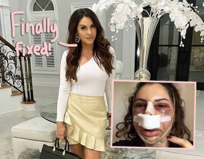 RHONJ's Jennifer Aydin Gets Chin Implant Removed A Few Months After Initial Surgery: 'No Idea How Whack I Would Look' - perezhilton.com - New Jersey - Turkey