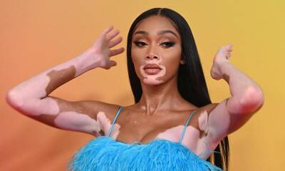 Winnie Harlow launches new skincare product after romantic holiday with Kyle Kuzma - us.hola.com