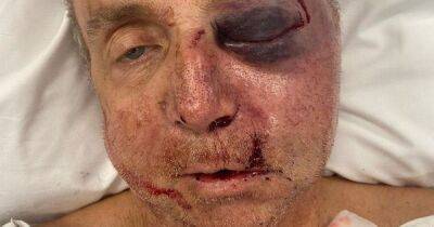 Man left disfigured by neighbour after being battered during garden dispute - www.dailyrecord.co.uk - city Victoria