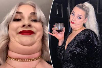 My double chin made me a TikTok star: ‘The reaction was crazy’ - nypost.com - Sweden
