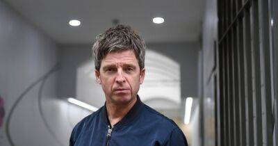 Noel Gallagher needs medical attention after being headbutted during soccer celebration - www.wonderwall.com - Manchester