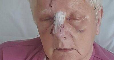 'I thought I was going to die': Pensioner savaged by 'pit bull-type' dog in bloodbath tells of her terror - www.manchestereveningnews.co.uk - Britain