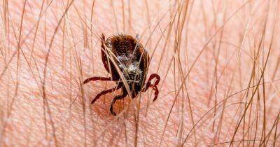 Lyme disease symptoms and how to get tested - www.dailyrecord.co.uk - Britain