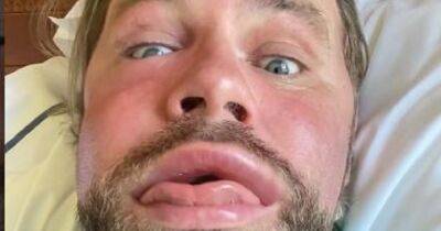 Brian McFadden alarms fans as he shares concerning video clip after being stung by a bee - www.manchestereveningnews.co.uk