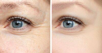 This Tightening Treatment Is Reportedly an Instant Eye Lift in a Tube - www.usmagazine.com