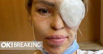 Katie Piper rushed into emergency surgery after husband spots hole in her eye - www.ok.co.uk