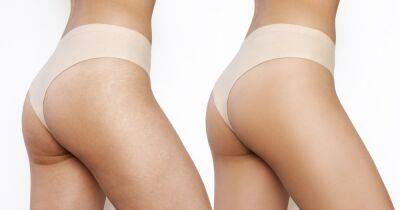 10 Best Cellulite Solutions to Diminish Dimples on Your Legs and Booty - www.usmagazine.com