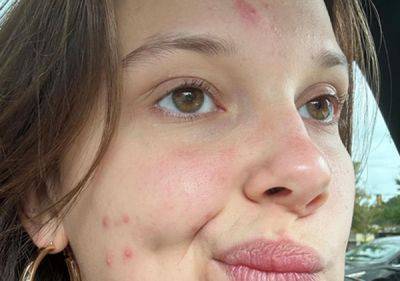 Millie Bobby Brown Shows Her Acne in Makeup-Free Selfie, Reveals How She Covered It Up - www.justjared.com