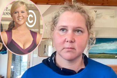 Amy Schumer Shares Shocking Before & After Pics -- Warning '20 Somethings' That 'Life Is Coming'! - perezhilton.com