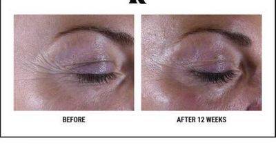 Beauty buffs floored by five-star rated anti-ageing cream clinically proven to 'lift' sagging eyes overnight - www.manchestereveningnews.co.uk
