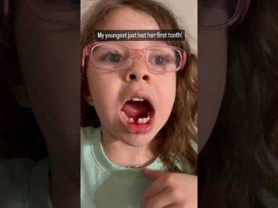 My Youngest Just Lost Her First Tooth! And... | Perez Hilton - perezhilton.com
