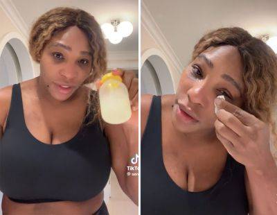 Serena Williams Puts Her Own Breast Milk On Sunburns! WHAT?! - perezhilton.com