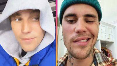Justin Bieber Proudly Shares Facial Mobility Progress After Ramsay Hunt Syndrome Diagnosis - www.etonline.com