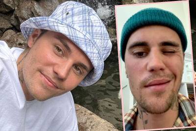 Justin Bieber Shares Update On Facial Paralysis Following Ramsay Hunt Syndrome Diagnosis - perezhilton.com