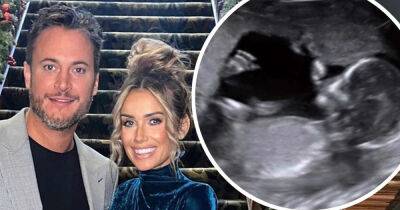 Laura Anderson's ex Gary Lucy reveals the gender of their unborn baby - www.msn.com
