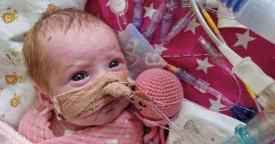 Parents who were told to 'say their goodbyes' to newborn with FOUR heart conditions say she's a 'fighter' - www.manchestereveningnews.co.uk - Manchester