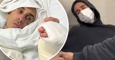 Travis Barker gives fans update after undergoing surgery on his finger - www.msn.com - Alabama