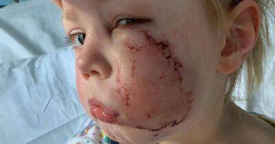 Girl, 4, mauled by American Bulldog needed 40 stitches and plastic surgery - www.dailyrecord.co.uk - USA - Beyond