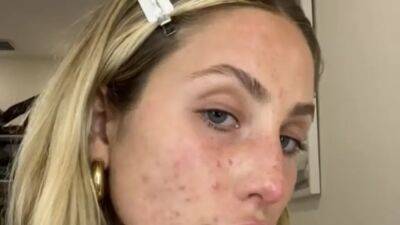 Alix Earle Goes Makeup-Free With a Message on TikTok - www.glamour.com