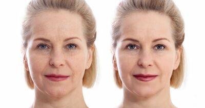 5 Types of Wrinkle Reduction! This Premium Face Cream Is Next Level - www.usmagazine.com - France