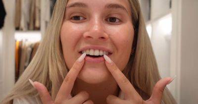 Molly-Mae Hague shows off teeth transformation after getting new smile at dentist - www.ok.co.uk - Hague