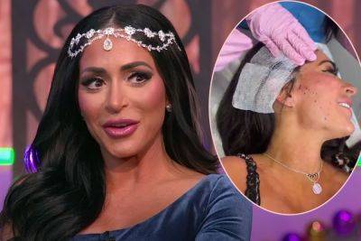 Jersey Shore’s Angelina Pivarnick Shocks Fans With Graphic Facelift Video! Watch! - perezhilton.com - Jersey