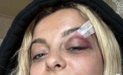 Singer Bebe Rexha Struck By Tossed Cell Phone At Manhattan Concert; Audience Member Charged With Assault - deadline.com - New Jersey