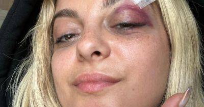 Bebe Rexha Shares Black Eye Photos After Fan Throws Phone at Her Face: ‘I’m Good’ - www.usmagazine.com - New York - New Jersey