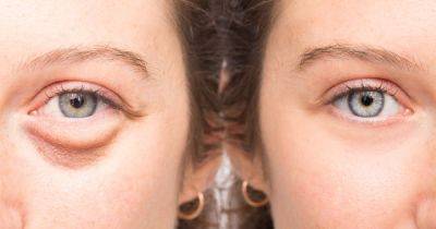 This Under-Eye Bags Treatment Works Like Magic to Reduce Puffiness and Fine Lines - www.usmagazine.com