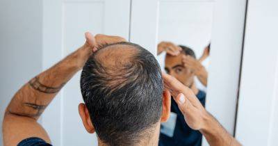 Baldness breakthrough as new treatment found to stimulate hair growth - www.dailyrecord.co.uk - Illinois - Beyond