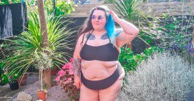 Woman, 24, bullied for ‘granny legs’ caused by health condition - www.manchestereveningnews.co.uk - Britain - Spain - Manchester