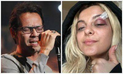 From Marc Anthony to Bebe Rexha: The stars who have got injured by fans throwing them items - us.hola.com - New York