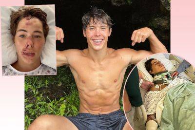 TikTok Star Caleb Coffee In ICU After Falling From ‘60 To 80-Foot’ Cliff In Hawaii - perezhilton.com - Hawaii - county Coffee