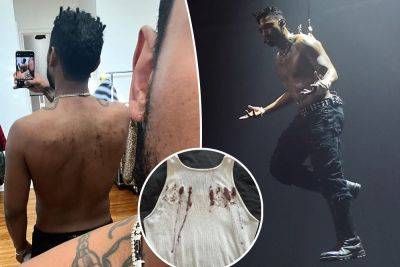 Miguel’s back piercing promo stunt leaves fans grossed out: ‘Hanging like a rotisserie chicken’ - nypost.com - Los Angeles