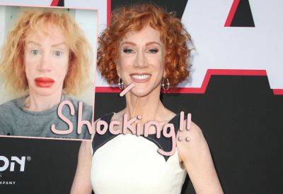 Kathy Griffin Unveils MASSIVELY Swollen Mouth After Getting Lips Tattooed! - perezhilton.com