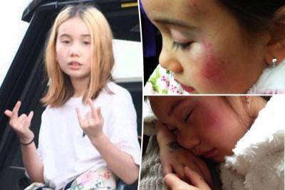 Lil Tay allegedly abused by family, ex-managers question death: reports - nypost.com - Canada